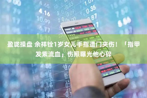 盈珑操盘 余祥铨1岁女儿手指遭门夹伤！　「指甲发紫流血」伤照曝光他心碎